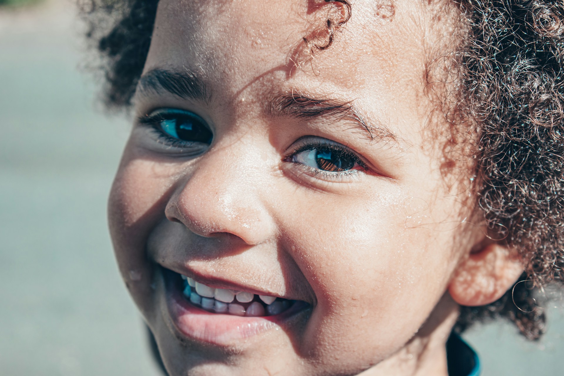 The Benefits of SDF Application for Children's Dental Health